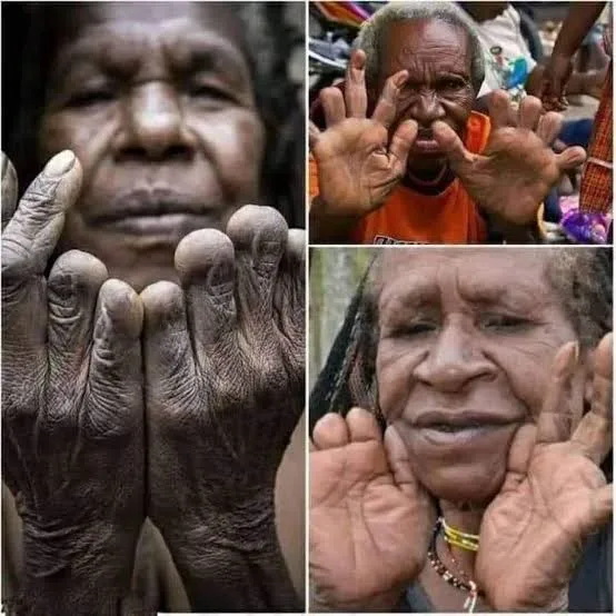 A collage of three images showing elderly people with deeply wrinkled hands and weathered skin, each holding their hands up…