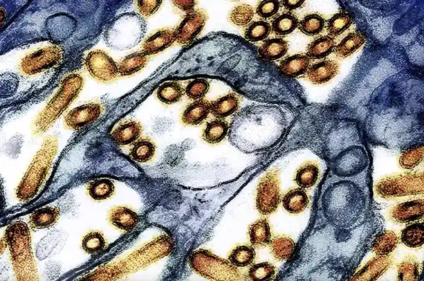 A microscopic image shows numerous brown, oval-shaped virus particles clustered on and within blue-gray cellular structures…
