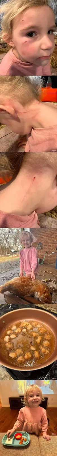 A vertical collage of five images shows a young girl with various minor scratches on her face, neck, and shoulder. The final…
