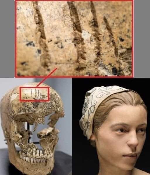 the image is a three-panel collage showing a close-up of grooves on a skull, the skull itself with a red box around the…
