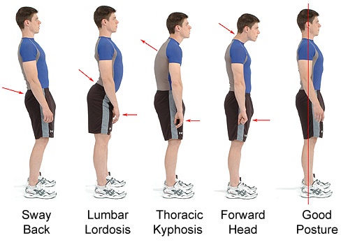 A sequence of five side-profile images of a man in athletic wear, each illustrating a progressively worse posture issue…