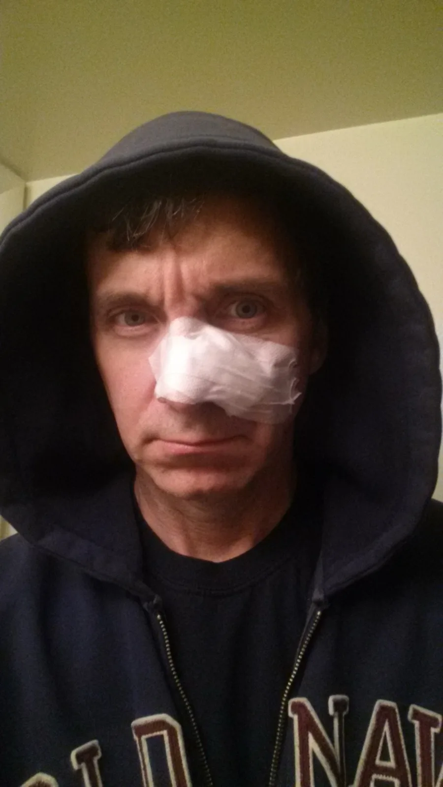 A man wearing a dark blue hoodie with the hood up stares directly at the camera with a serious expression. A white gauze…