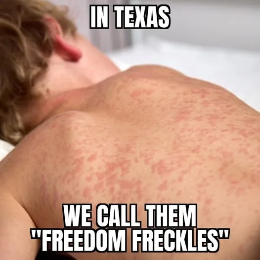 A person is lying face down on a bed, exposing their back which is covered in numerous red, raised, irritated-looking spots…