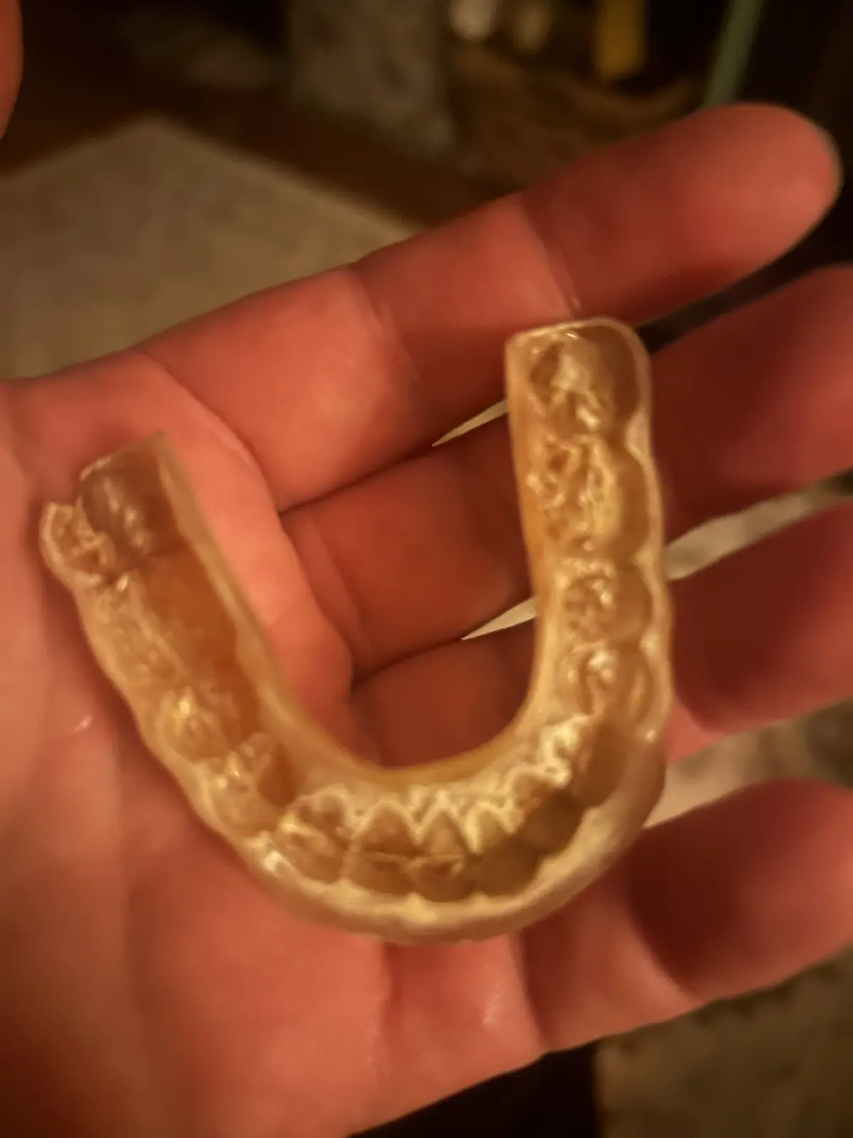 A close-up photo shows a person's hand holding a clear, U-shaped dental retainer with visible teeth impressions. The…