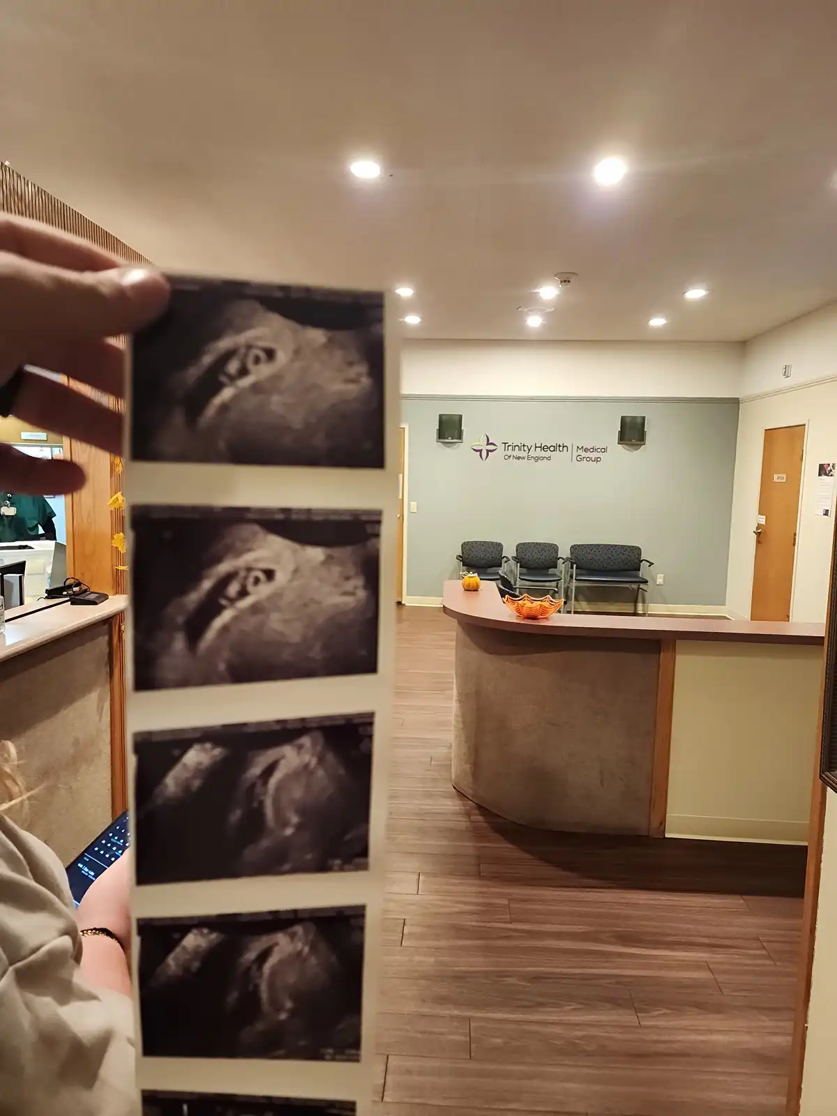 A person holds up a strip of four ultrasound images in a medical office lobby, with the text 'i'm not sure if i'm having a…