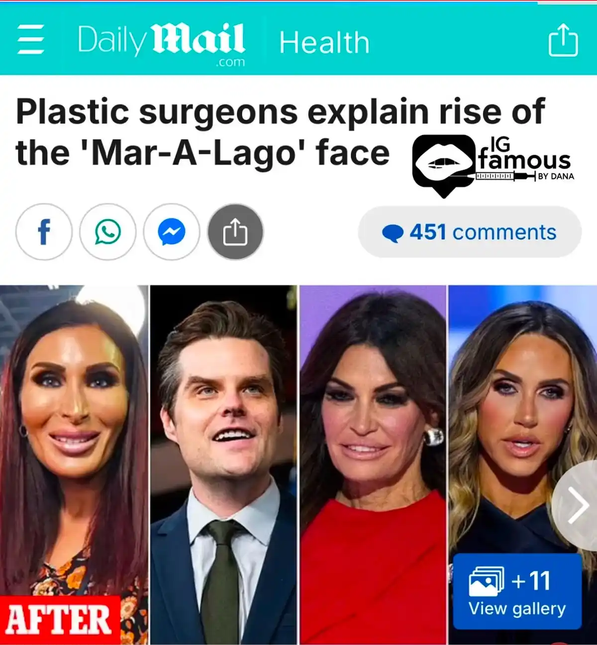 A screenshot of a Daily Mail Health article titled 'Plastic surgeons explain rise of the 'Mar-A-Lago' face' shows four…