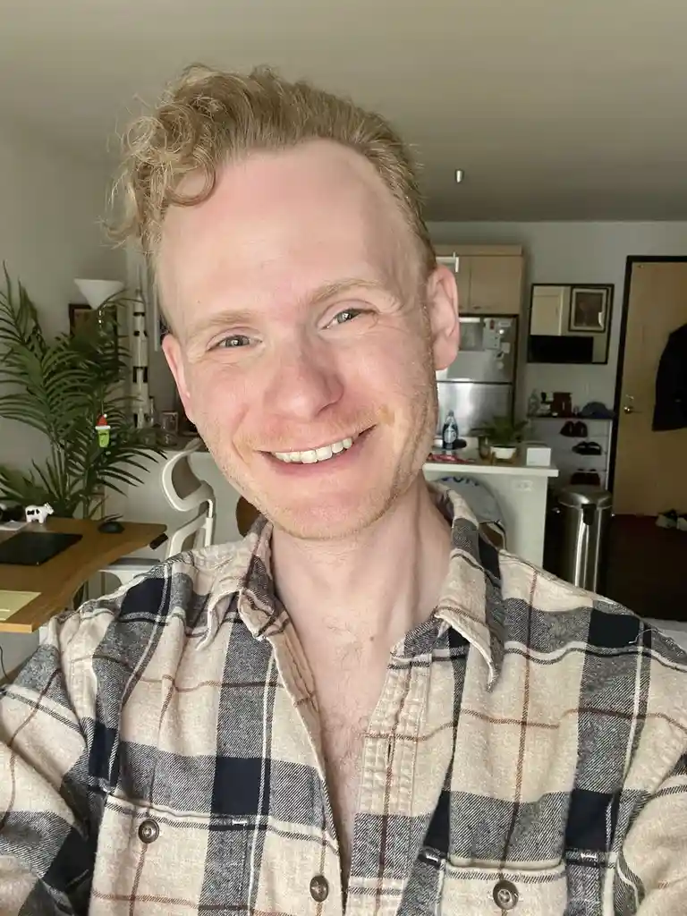 Xmas Selfie: Trying to Brighten Up After My Breakup Last Week… Happy Holidays!