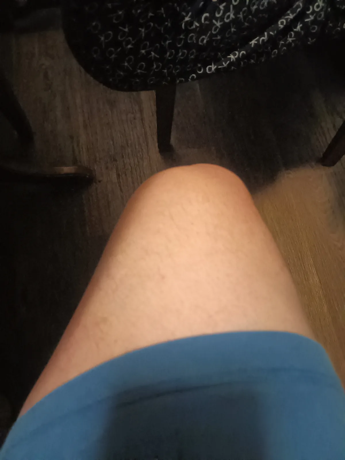A close-up, first-person view of a person's bare thigh, showing light skin and some hair, wearing blue shorts. The…