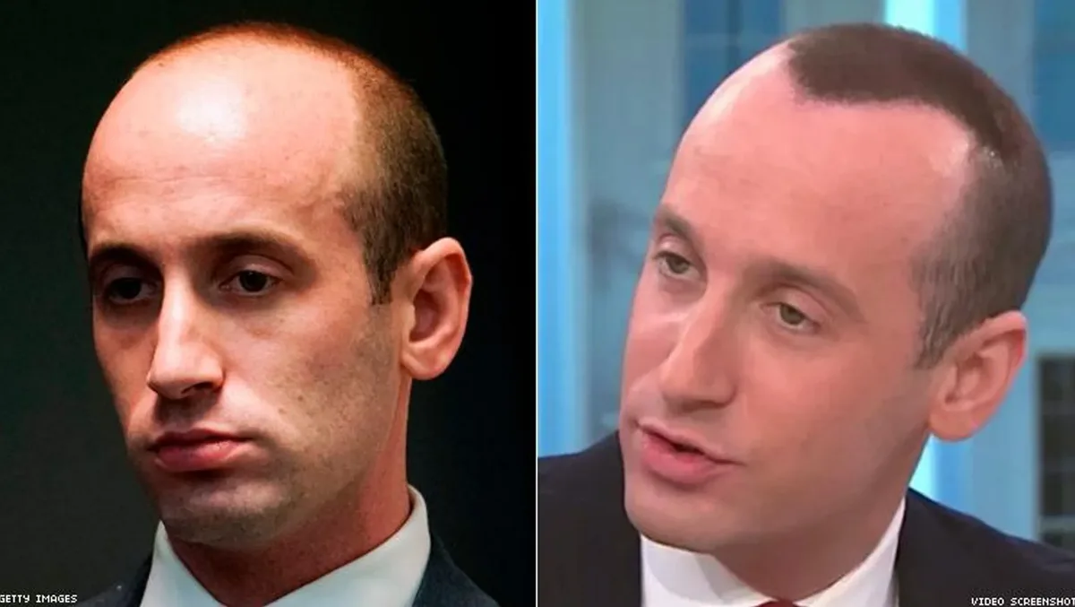 The image shows a split-screen of a man with a receding hairline on the left and the same man with a fuller, more styled…