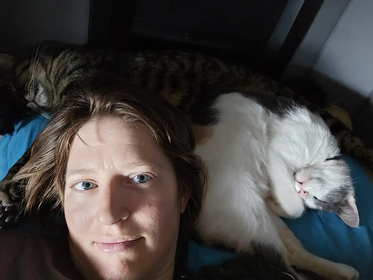 A person with blue eyes lies on a bed, looking directly at the camera with a tired expression, while two cats—one tabby and…