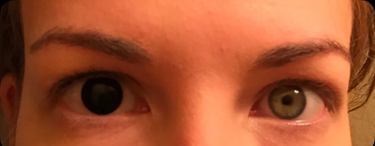 The Allure of Blackout Contacts