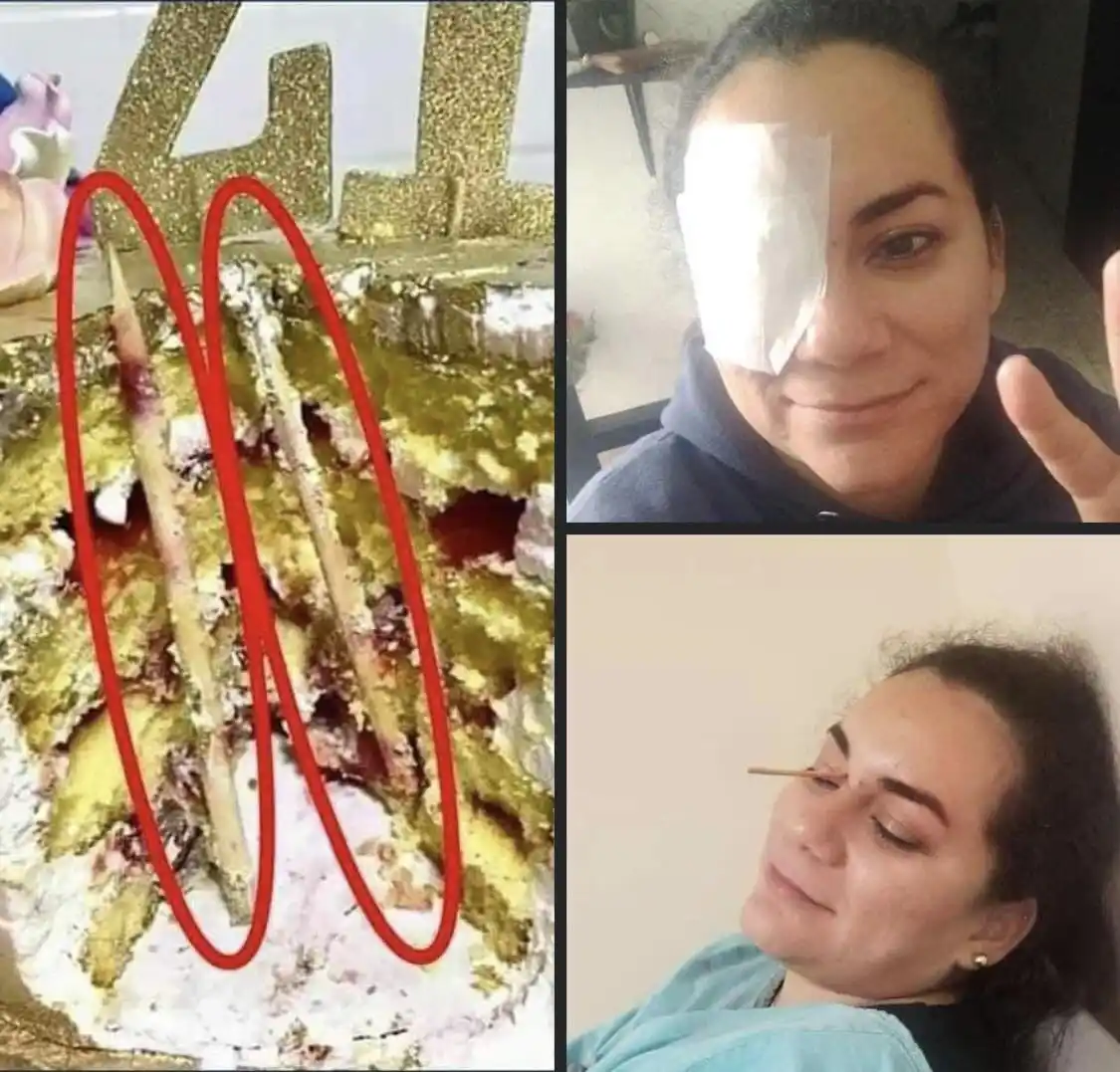A collage shows a cake with gold glitter and the number '41' on top, with red circles highlighting two long, thin, bloody…