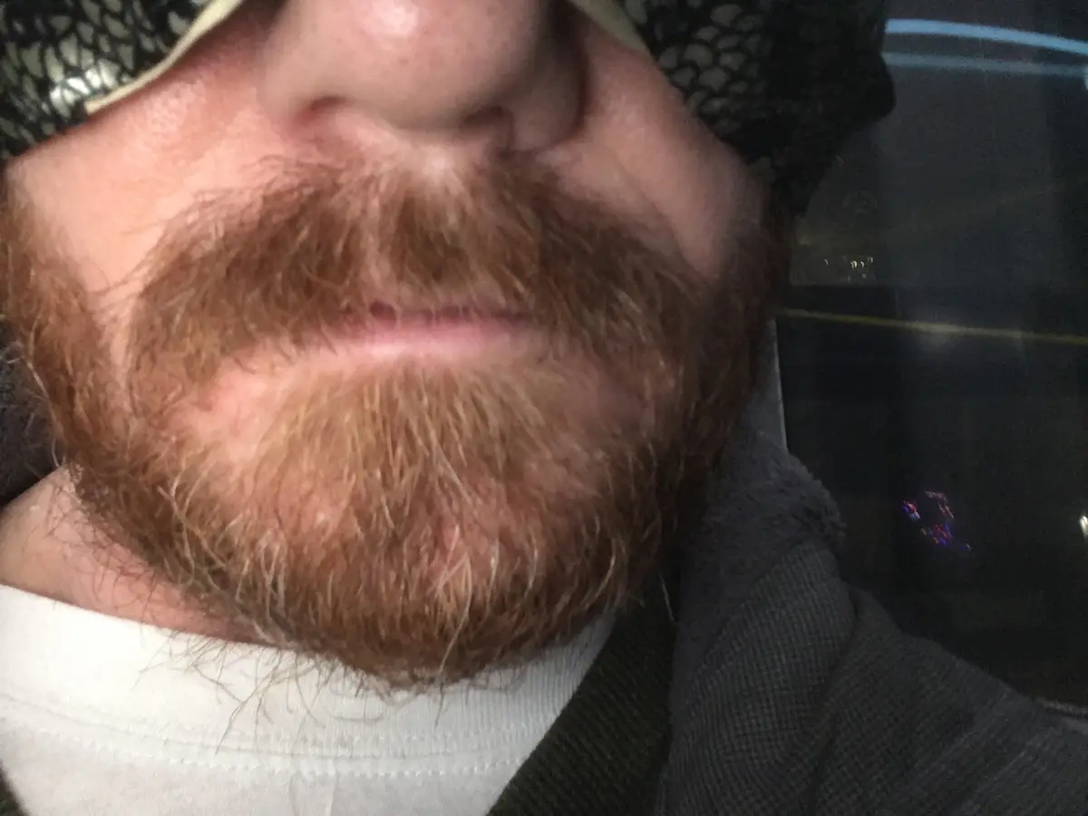 A close-up selfie of a man's lower face showing his full reddish-brown beard and mustache, with a white t-shirt collar and…