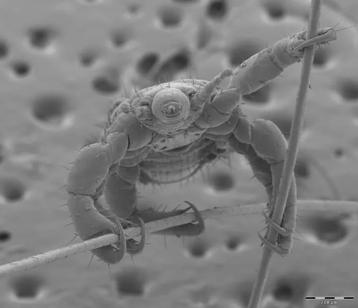 A black-and-white scanning electron microscope image shows a detailed close-up of a tiny arachnid-like creature with spiny…