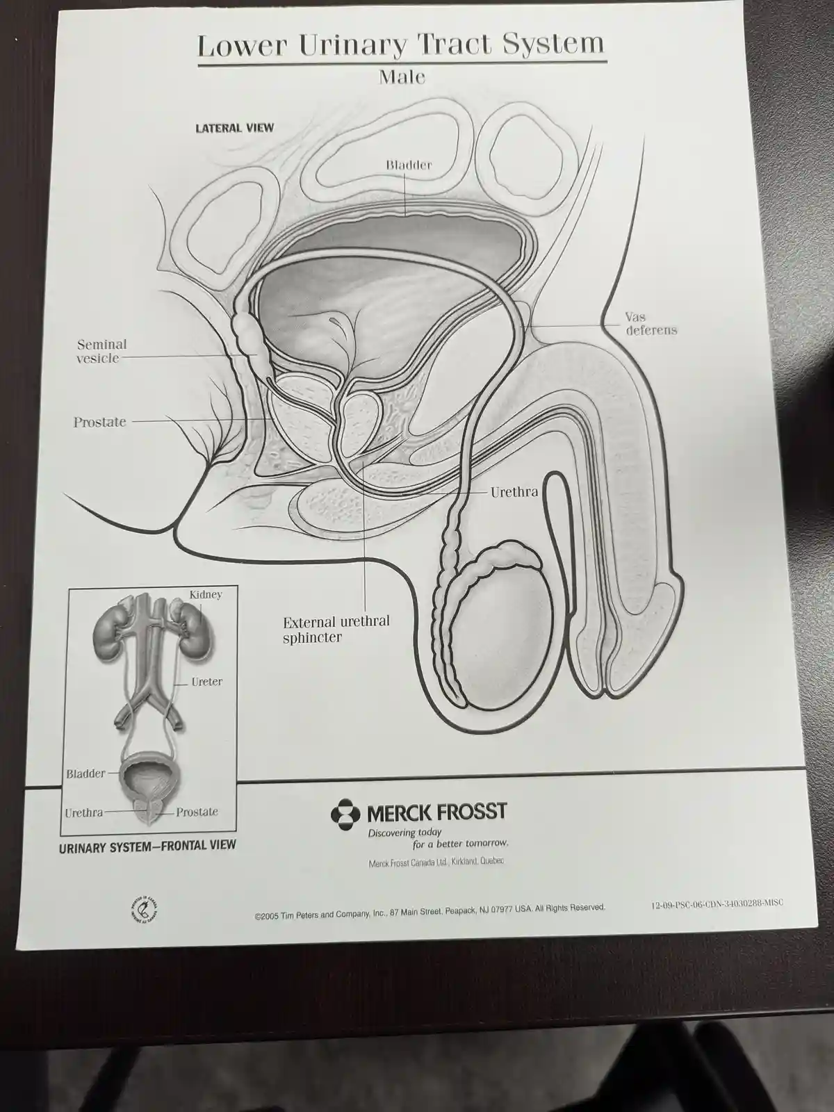 This is a medical diagram titled 'Lower Urinary Tract System Male' showing anatomical structures like the bladder, prostate…