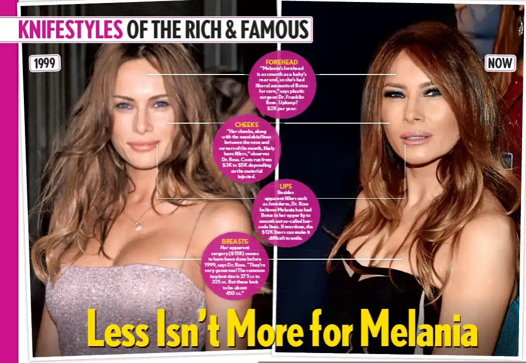 The image displays two side-by-side photos of Melania Trump, labeled '1999' on the left and 'NOW' on the right, with purple…