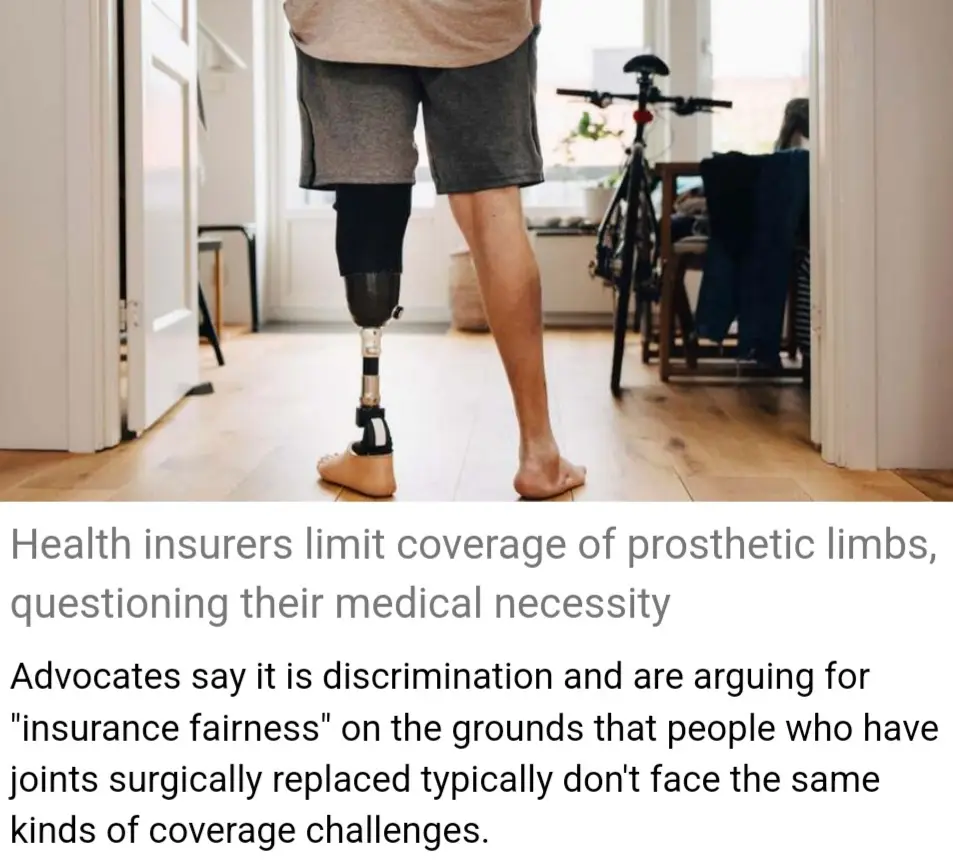 A person viewed from behind, standing barefoot in a home with one prosthetic leg and one natural leg. The image includes…
