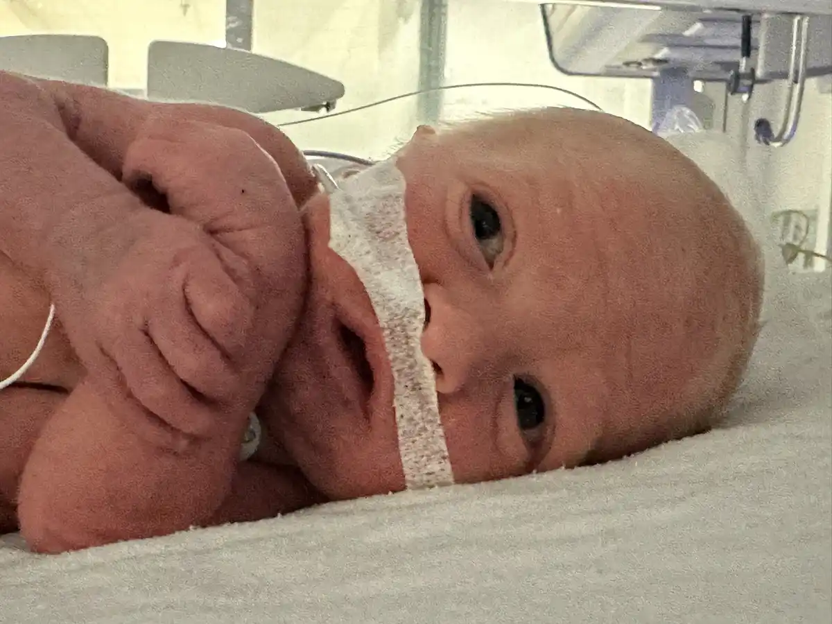 A newborn baby lies in a hospital incubator, looking directly at the camera with wide eyes, one hand near its face. A…