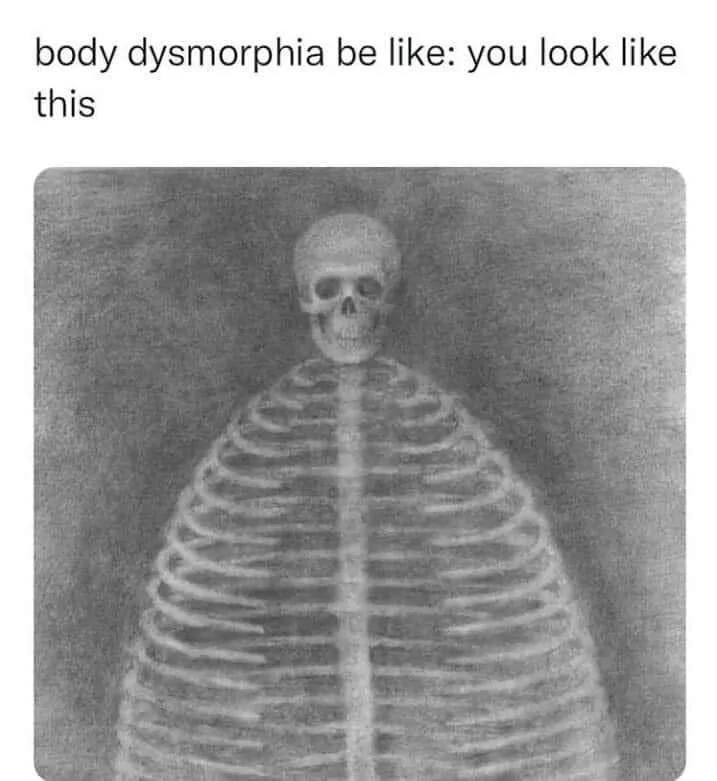 An x-ray image shows a human skeleton with a skull and ribcage clearly visible against a dark background. Overlaid text…