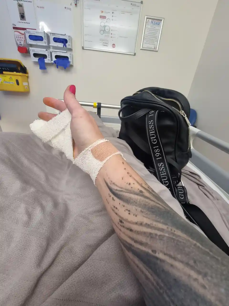 A person is lying in a hospital bed with their left hand wrapped in a white bandage, showing a visible tattoo on their…