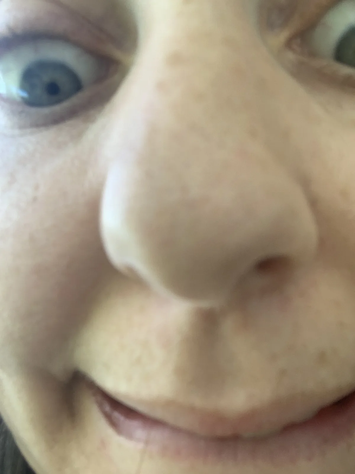 A close-up, slightly blurry photo of a person's face, focusing on their nose and eyes. Their eyes are wide open and staring…