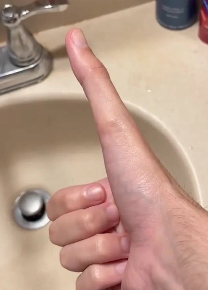 A close-up photo shows a person's hand with the thumb extended upward, positioned over a beige bathroom sink with a chrome…