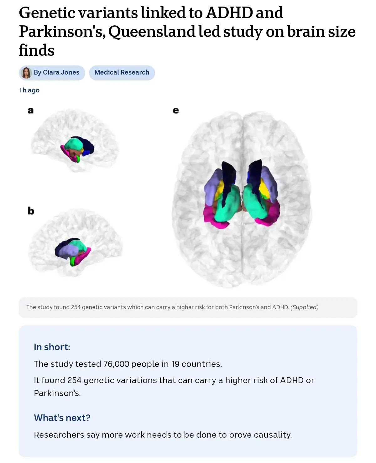 A screenshot of a news article about a Queensland-led study on brain size, featuring three 3D brain scans with colored…