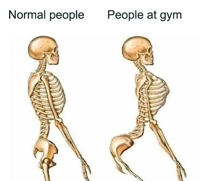 The image displays two side-by-side anatomical illustrations of human skeletons. The left skeleton is labeled 'Normal…