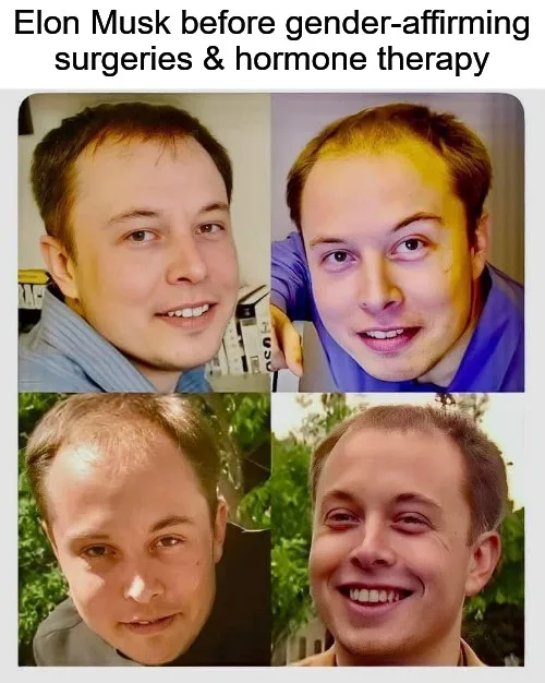 The image is a four-panel collage showing four different photos of Elon Musk. The top-left photo shows him with a full head…