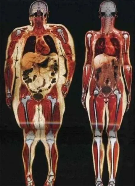 Two anatomical illustrations show human bodies with internal organs visible. The left body is labeled 'before' and has a…