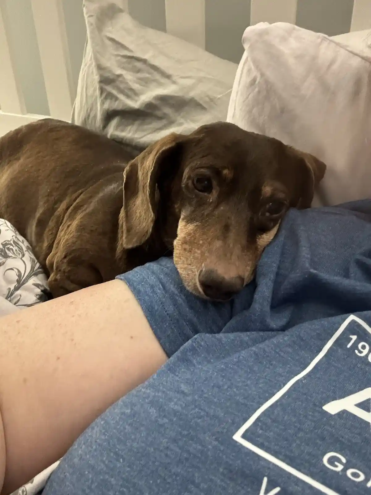 A brown dachshund with sad, watery eyes rests its head on a person's blue t-shirt while lying on a bed with white pillows…