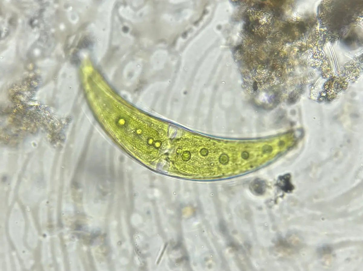 A microscopic image shows a curved, translucent green organism with visible internal circular structures, resembling a tiny…