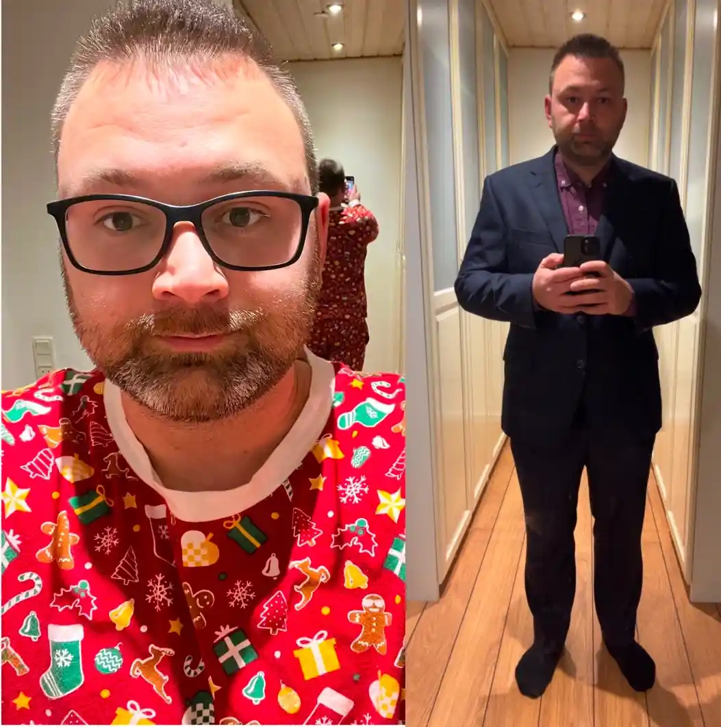A split image shows a man in a red holiday-themed pajama top with festive patterns like gingerbread men and snowflakes on…