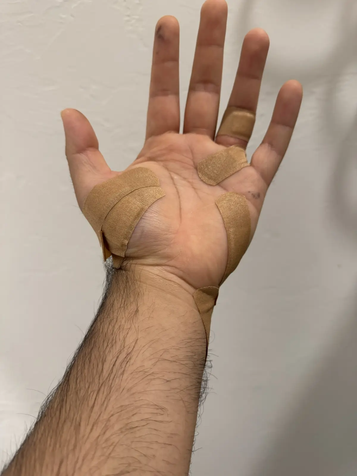 A close-up photo shows a person's left hand with multiple beige adhesive bandages covering the palm and fingers, resembling…