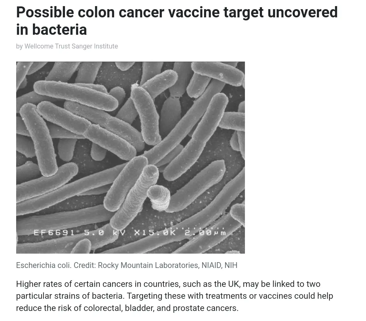 A black-and-white electron microscope image shows rod-shaped Escherichia coli bacteria. Overlaid text reads 'Possible colon…