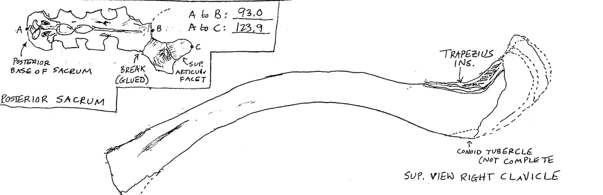 A hand-drawn anatomical sketch shows a right clavicle with detailed labels like 'POSTERIOR SACRUM', 'BREAK (GLUED)', and…