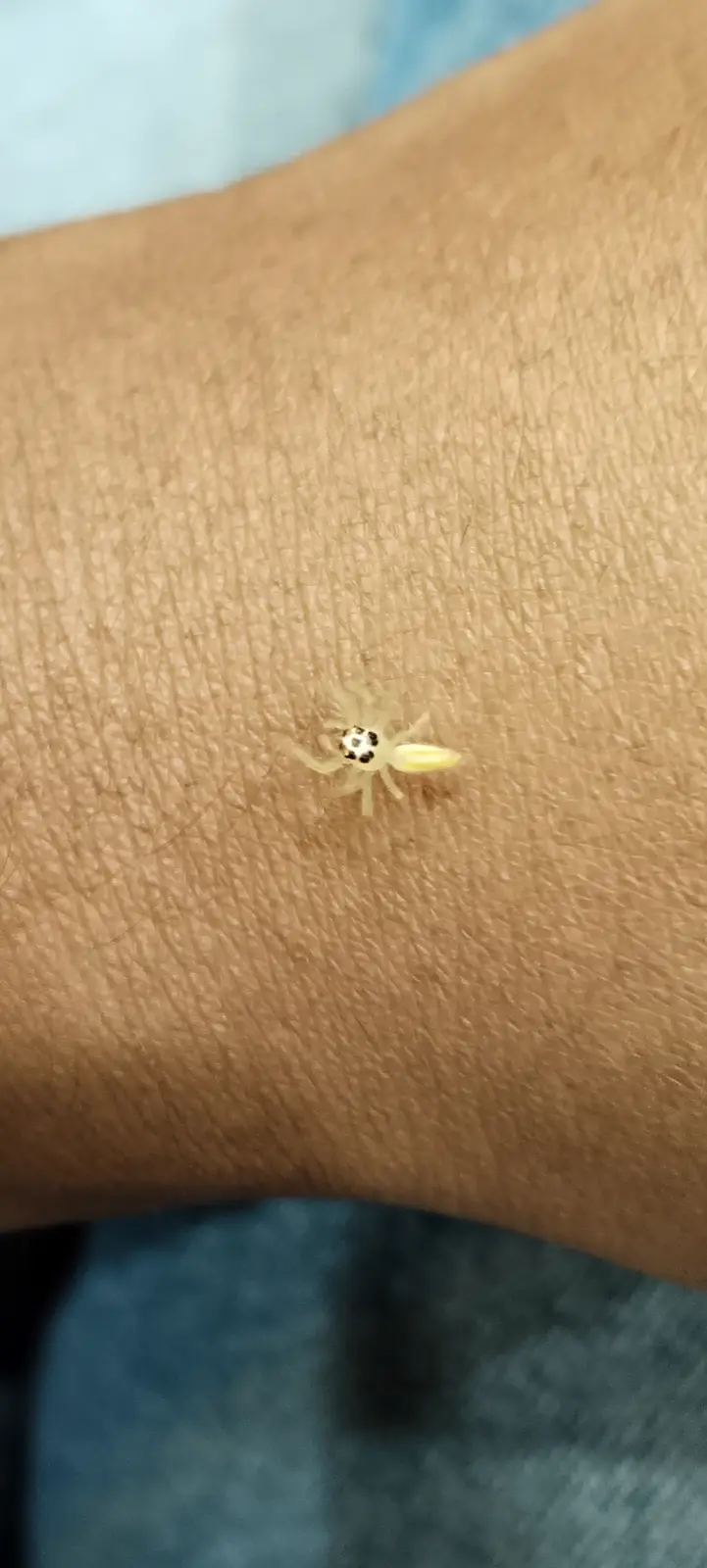 A small, pale yellow spider with a distinctive black and white pattern on its head is resting on a person's arm. The arm has…