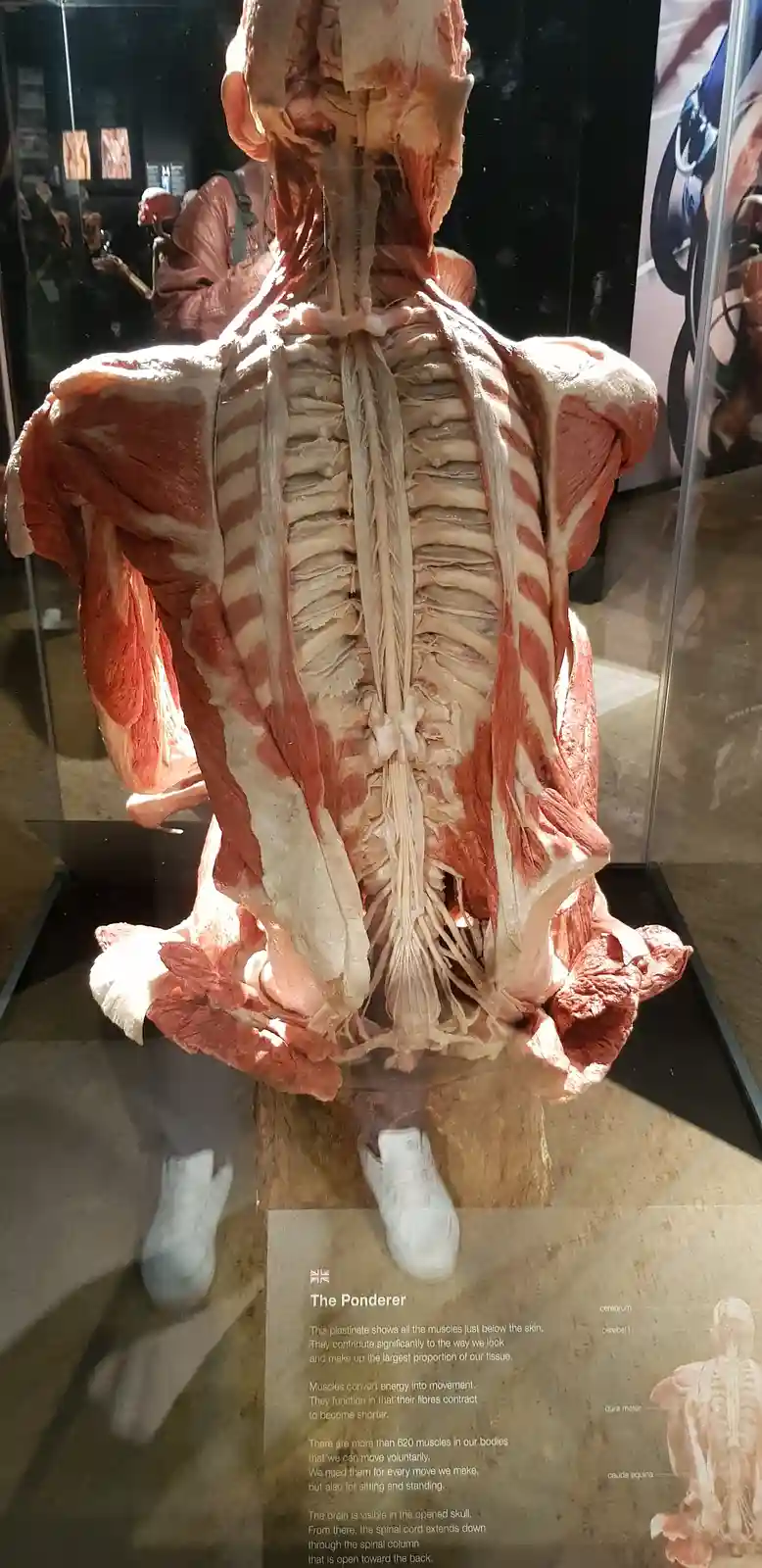 A plastinate of a human torso, displayed in a museum case, shows all muscles beneath the skin with the skull open, revealing…