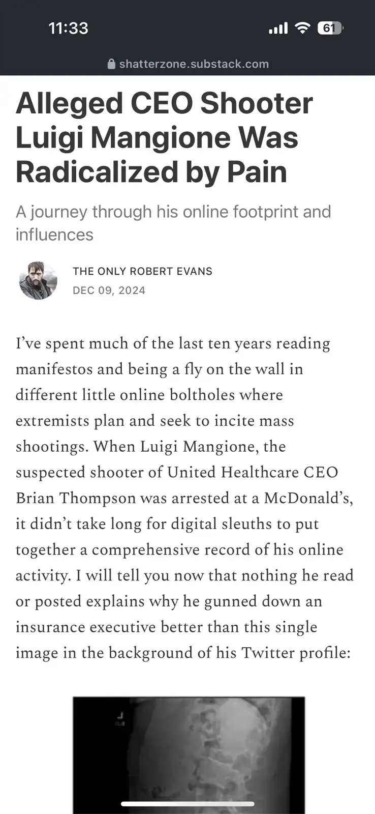 A screenshot of a Substack article titled 'Alleged CEO Shooter Luigi Mangione Was Radicalized by Pain' by 'THE ONLY ROBERT…