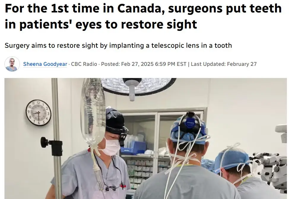 A screenshot of a news article headline about a medical procedure in Canada where surgeons implant telescopic lenses into…