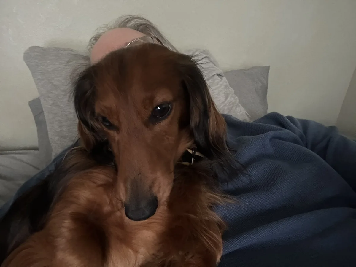 A long-haired dachshund with a brown coat is lying on a person's chest, partially covered by a blue blanket, while the…