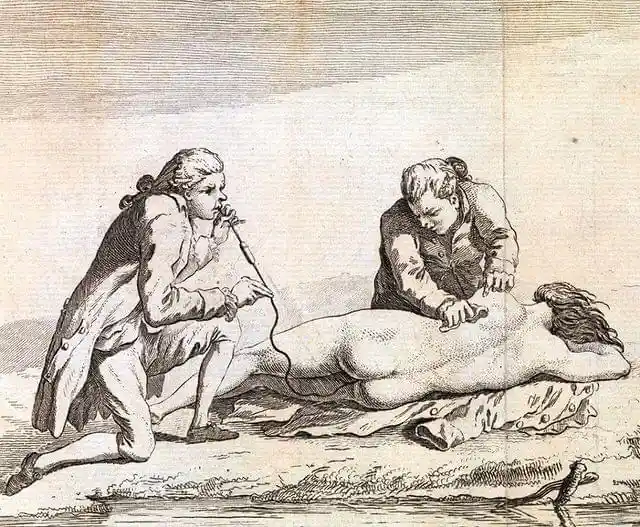 An old etching depicts two men attending to a prone, nude woman; one kneels and presses on her chest while the other blows…