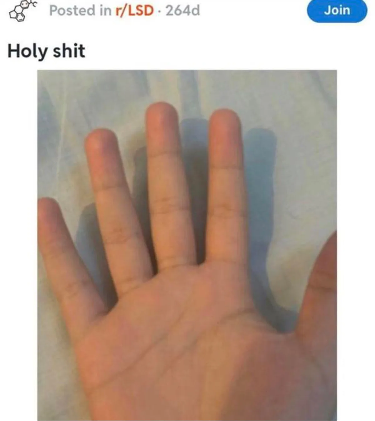 A close-up photo shows a person's open palm with five fingers clearly visible, resting on a light-colored fabric surface…