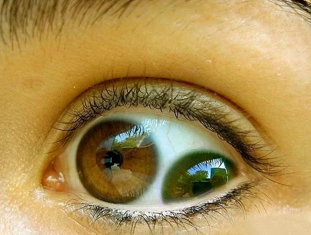 A close-up photo of a human eye with a brown iris, showing a reflection of green foliage in the pupil. The overlaid text…