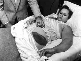 A black-and-white photo shows a man lying in bed, partially covered by a sheet, with a doctor standing beside him. The…