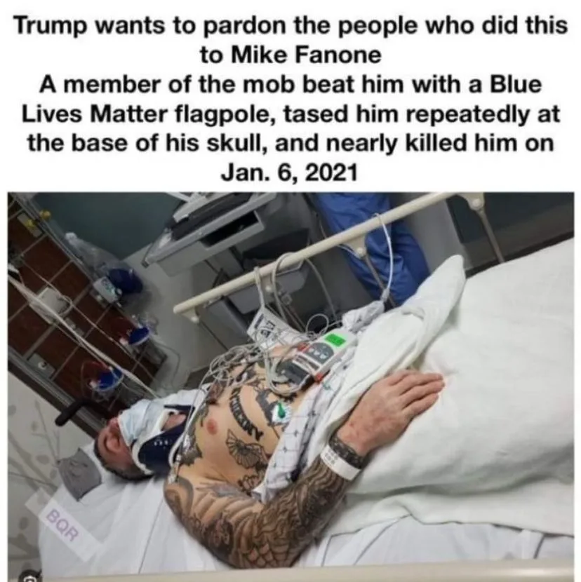 A man with extensive tattoos lies in a hospital bed, connected to medical equipment and wearing a neck brace. The overlaid…