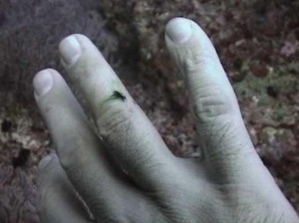 A close-up image shows a human hand with a small, dark insect resting on the middle finger. The background is blurry and…