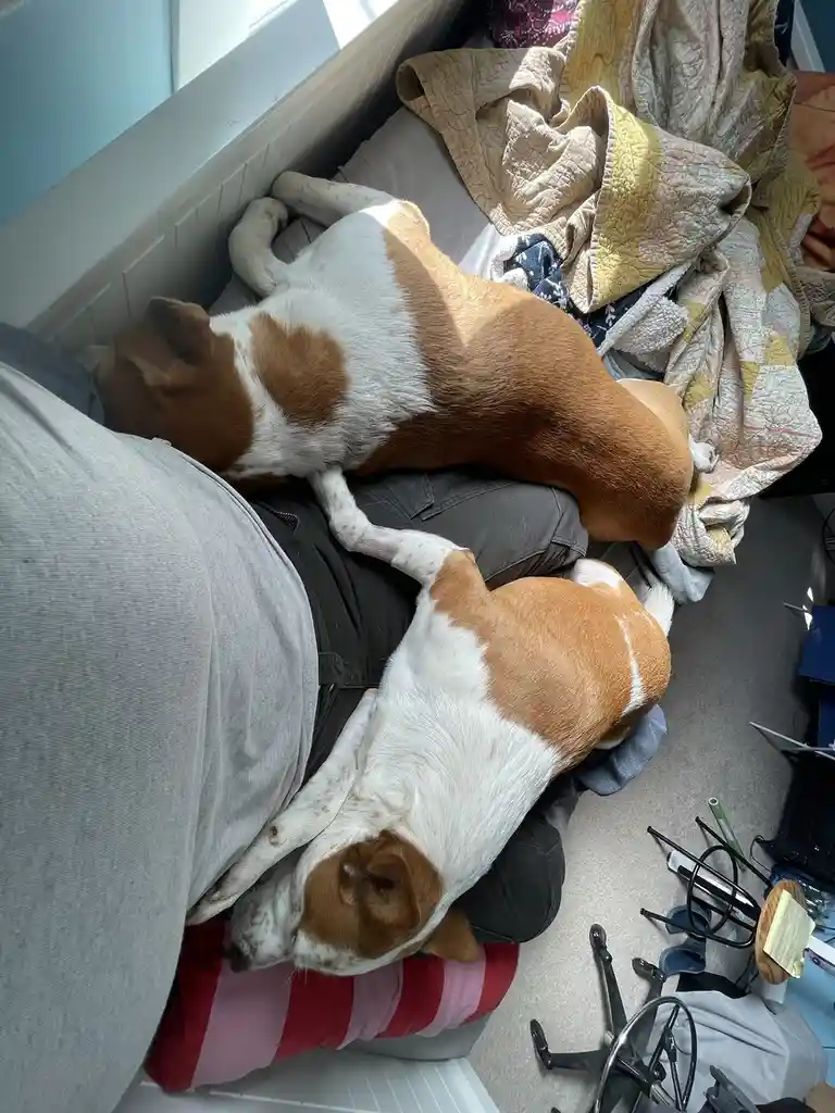 Two brown and white dogs are curled up sleeping on a person's lap and torso while they sit on a bed with blankets. The…