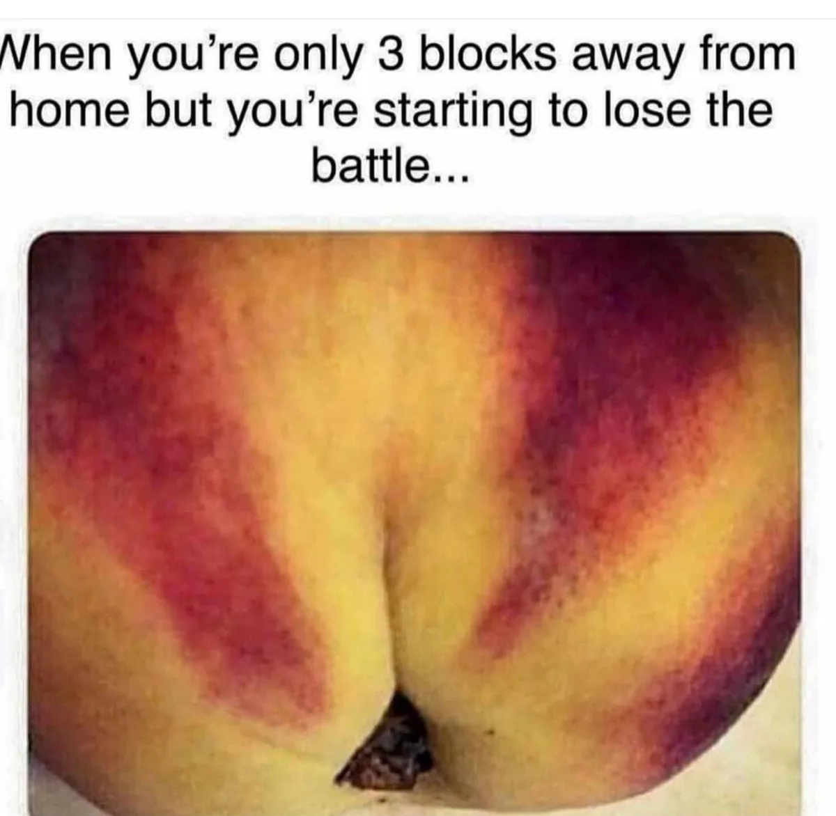 The image shows a close-up of a peach with its natural indentation resembling a human buttocks. Overlaid text reads: 'When…