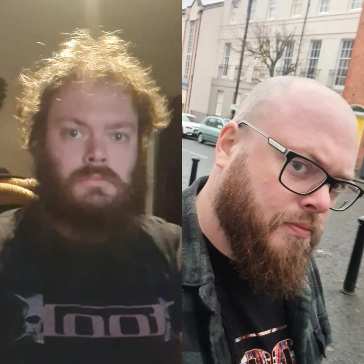 Christmas Selfie After Shaving My Head!